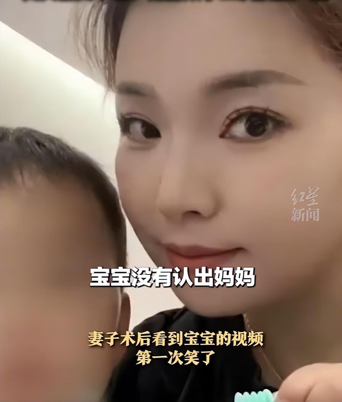 烧伤妈妈后续!丈夫崩溃透露:她状态很差,不想治了想回家。