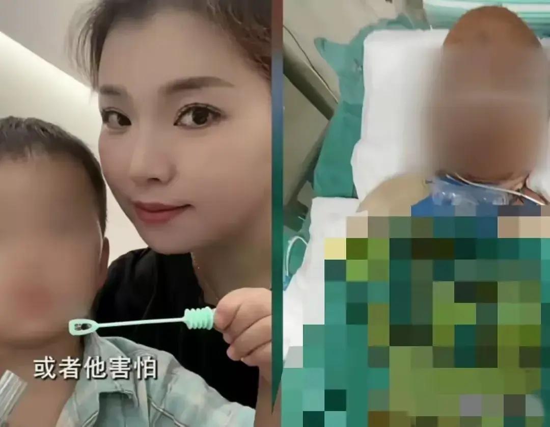 烧伤妈妈后续!丈夫崩溃透露:她状态很差,不想治了想回家。