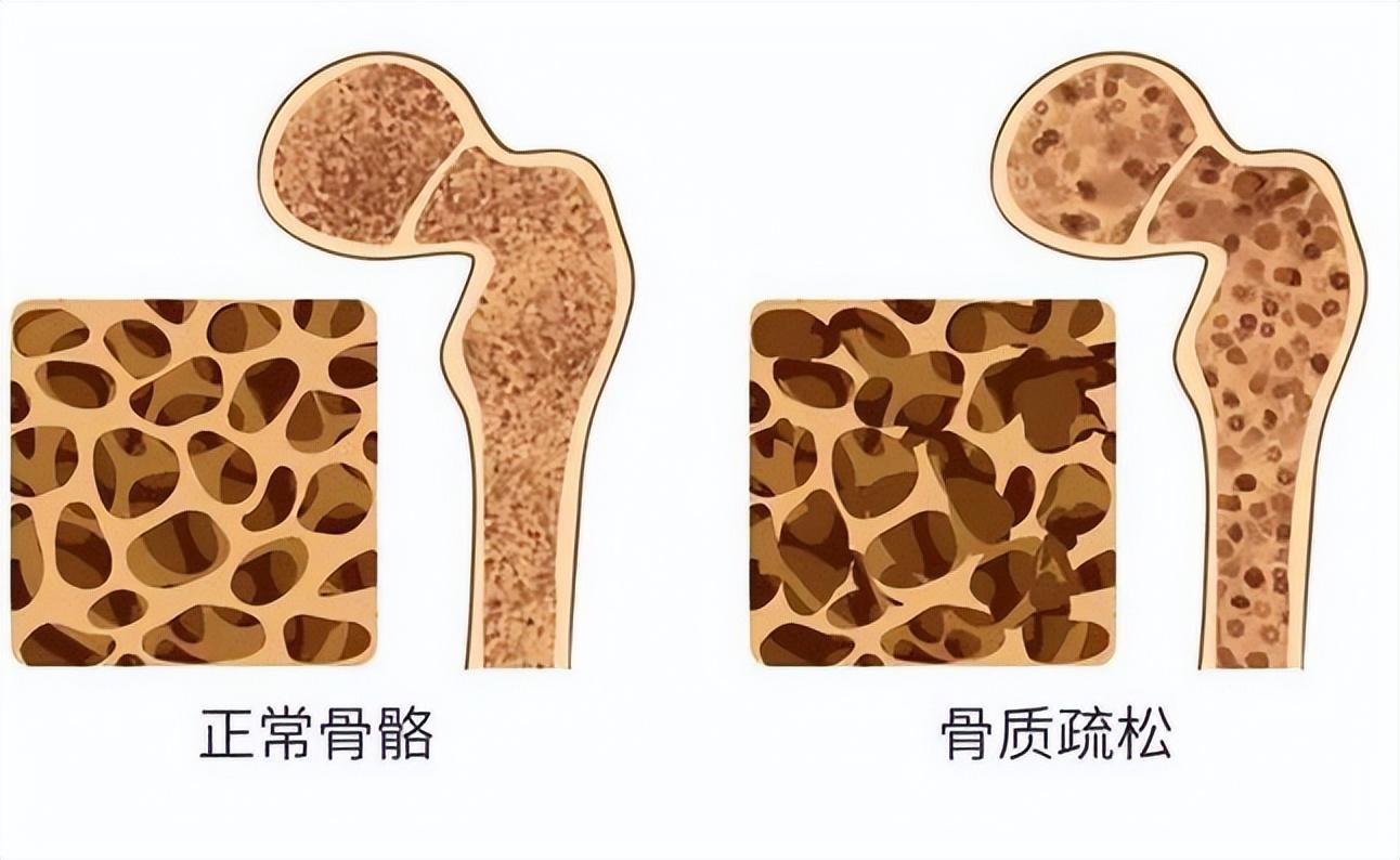 研究发现:一旦吃上降压药,3件事就别做了,不要害了自己?