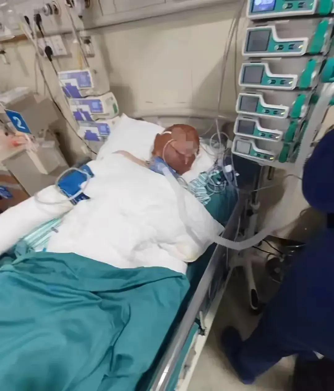 烧伤妈妈后续!丈夫崩溃透露:她状态很差,不想治了想回家。