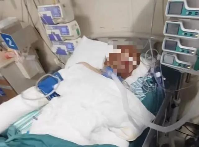 烧伤妈妈后续!丈夫崩溃透露:她状态很差,不想治了想回家。